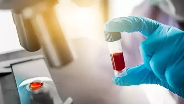 Foto - En dirençli kan grubu belli oldu! Kanser riski daha az