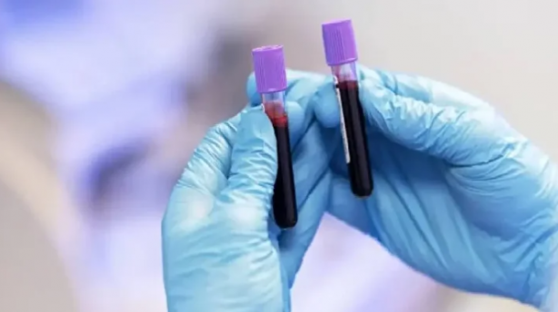 Foto - En dirençli kan grubu belli oldu! Kanser riski daha az