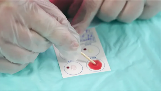 Foto - En dirençli kan grubu belli oldu! Kanser riski daha az