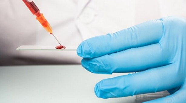 Foto - En dirençli kan grubu belli oldu! Kanser riski daha az