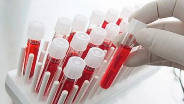 Foto - En dirençli kan grubu belli oldu! Kanser riski daha az