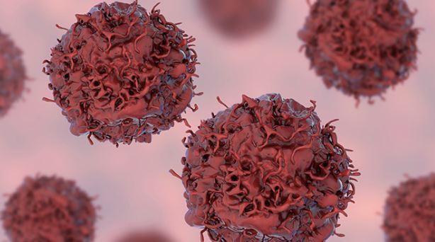 Foto - En erken evre kanser belirtileri açıklandı! Zamanlama hayat kurtarıyor