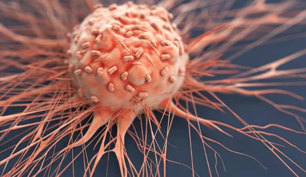 Foto - En erken evre kanser belirtileri açıklandı! Zamanlama hayat kurtarıyor