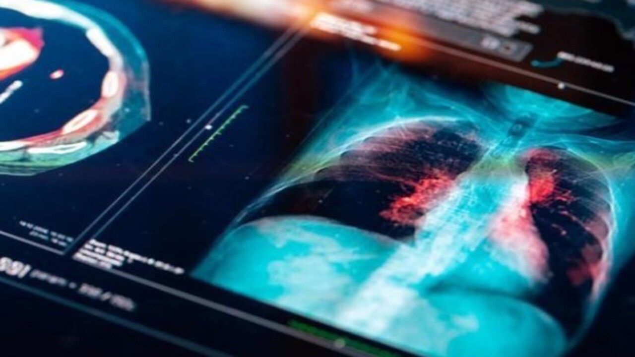 Foto - En fazla ölüme yol açan enfeksiyon açıklandı! Kimler risk altında