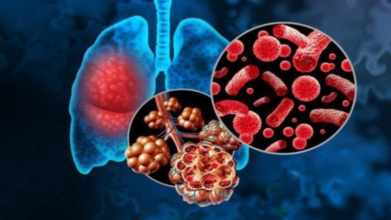 En fazla ölüme yol açan enfeksiyon açıklandı! Kimler risk altında