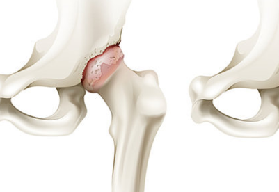 Foto - En ilginç 25 bilgi! Kafaları kopsa bile birkaç hafta yaşarlar