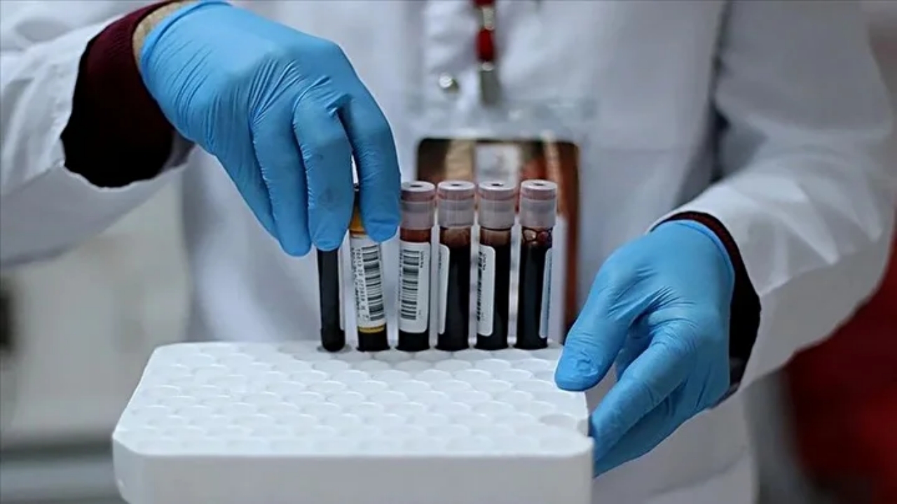 Foto - En nadir kan grubu ortaya çıktı: O kişilerde "altın kan" var