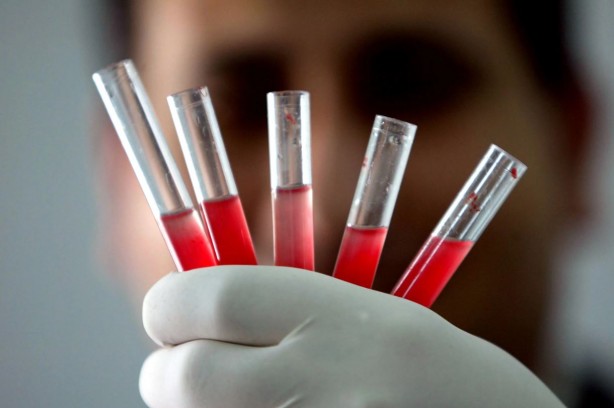 Foto - En uzun yaşayan ve hasta kan grubu ortaya çıktı! Bu kana sahip olanlar çok şanslı! İşte ömrü uzun olan kan grupları