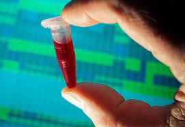 En zeki kan grubu belli oldu! O kana sahip olanların beyni...