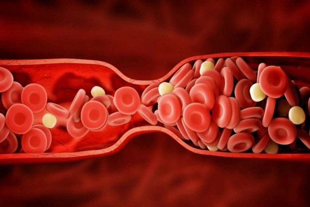 Foto - En zeki kan grubu belli oldu! O kana sahip olanların beyni...
