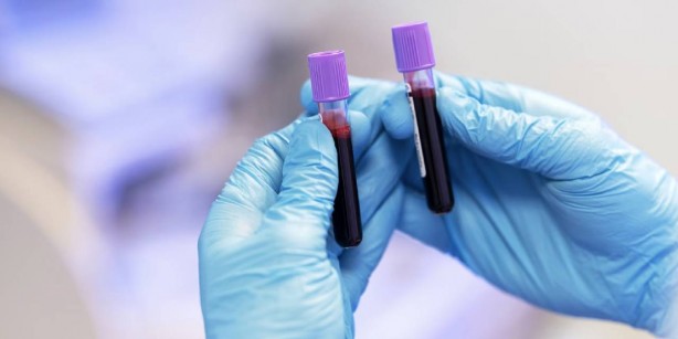 Foto - En zeki kan grubu belli oldu! O kana sahip olanların beyni...