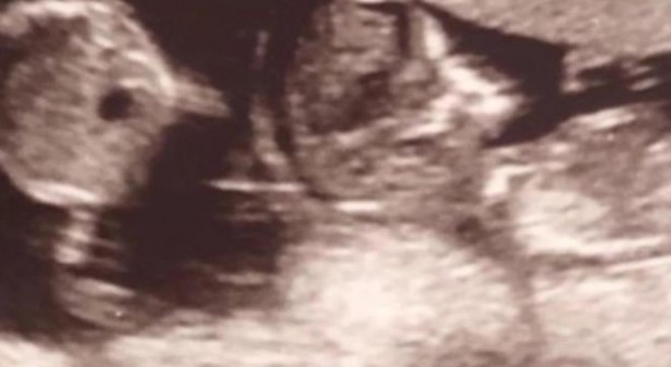 Foto - Ender rastlanan olay! Hamileyken hamile kaldı!