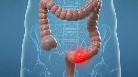 Foto - Enerji içecekleriyle ilgili şok iddia!