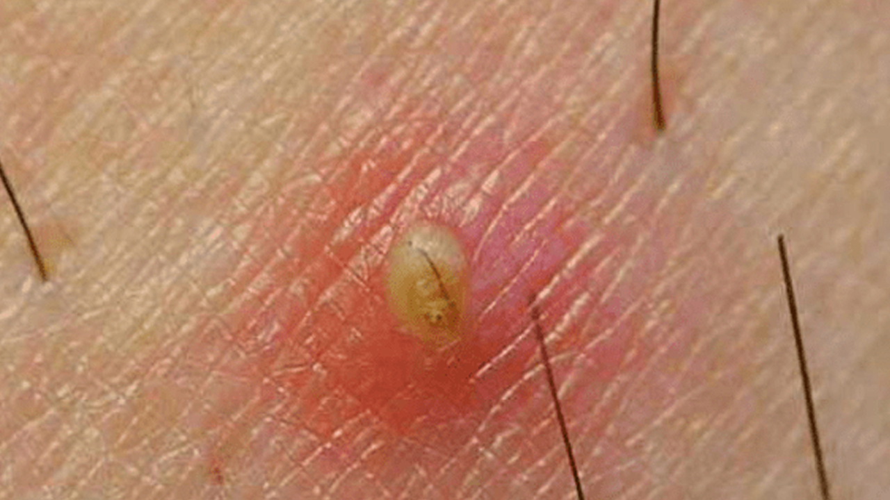 Foto - Prof. Dr. İbrahim Saraçoğlu'dan öneri: Erkeklerin kabusu kıl dönmesine 15 dakika bekletmek yetiyor 