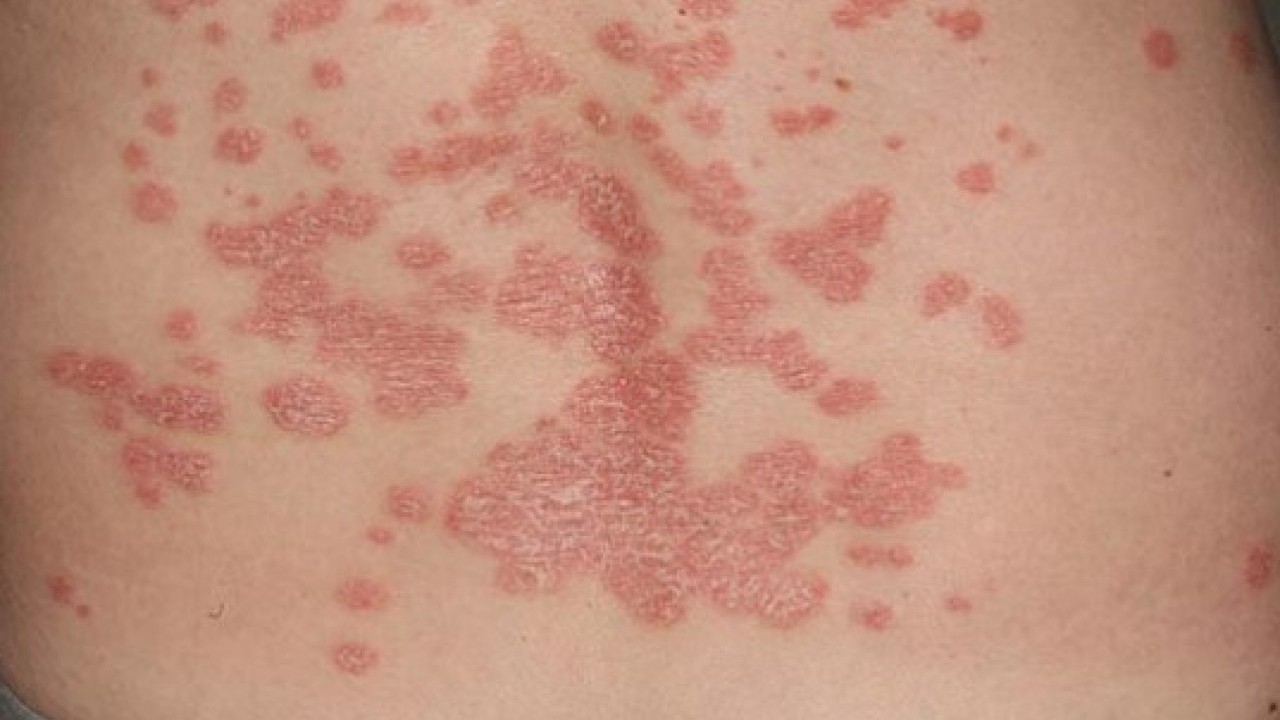 Foto - Erken tanı çok önemli: Bu işaretleri hafife almayın!