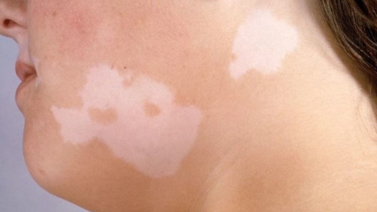 Erken tanı çok önemli: Bu işaretleri hafife almayın!