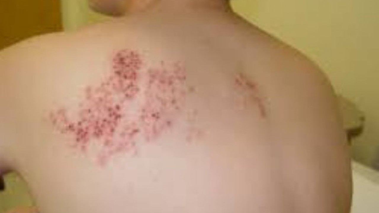 Foto - Erken tanı çok önemli: Bu işaretleri hafife almayın!