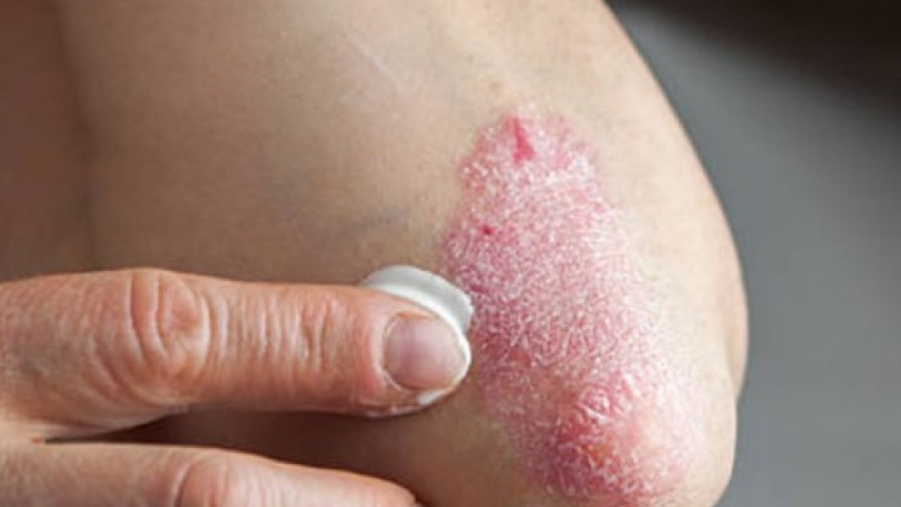 Foto - Erken tanı çok önemli: Bu işaretleri hafife almayın!