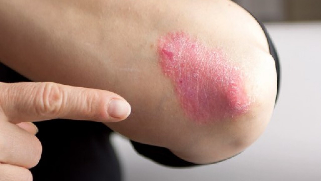 Foto - Erken tanı çok önemli: Bu işaretleri hafife almayın!