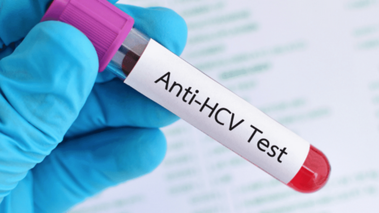 Erken tanı ve tedavi hayat kurtarıyor: Hepatit B ve C testinizi sakın ihmal etmeyin!