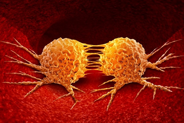 Foto - Erken yaşlarda görülmeye başlandı! İşte baş ve boyun kanseri riskini arttıran besinler