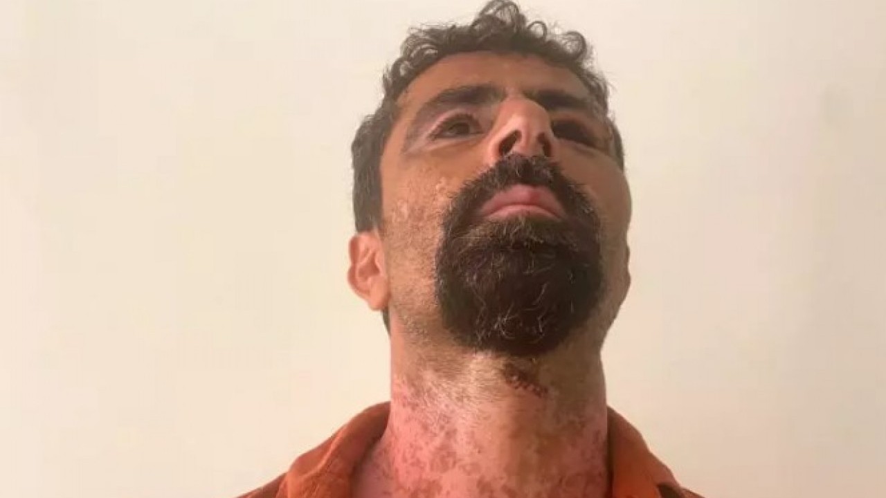 Foto - Eşine kızdı kayınpederini öldüresiye dövdü!