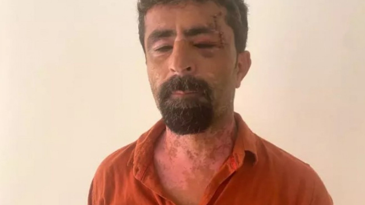 Eşine kızdı kayınpederini öldüresiye dövdü!