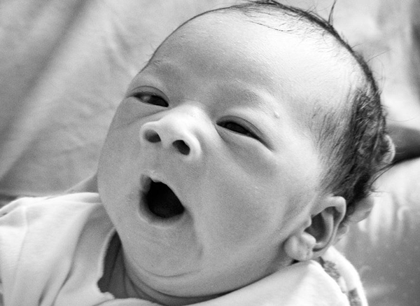 Foto - Esneme neden bulaşıcıdır?