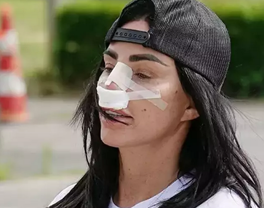 Foto - Estetik manyağı dedikleri bu olsa gerek: Bu kadarı da pes: Dikkat çeken görüntü: Kritik detay