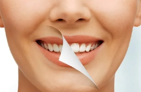 Evde diş beyazlatma yöntemleri neler? İşte o mucize teknikler… Diş beyazlatma işlemi nedir, nasıl yapılır?