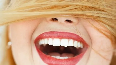 Foto - Evde diş beyazlatma yöntemleri neler? İşte o mucize teknikler… Diş beyazlatma işlemi nedir, nasıl yapılır?