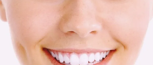 Foto - Evde diş beyazlatma yöntemleri neler? İşte o mucize teknikler… Diş beyazlatma işlemi nedir, nasıl yapılır?