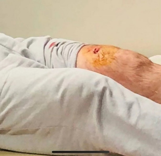 Foto - Evinin önünde ayı saldırdı: Bacaklarımdan tutup yere düşürdü