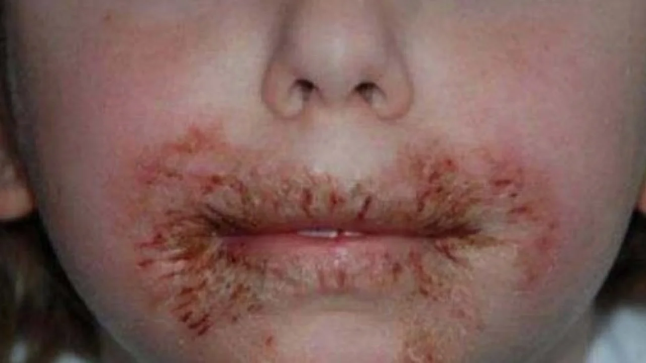 Foto - Evlerinizde kullanırken dikkat! Islak mendillerdeki büyük tehlike belli oldu