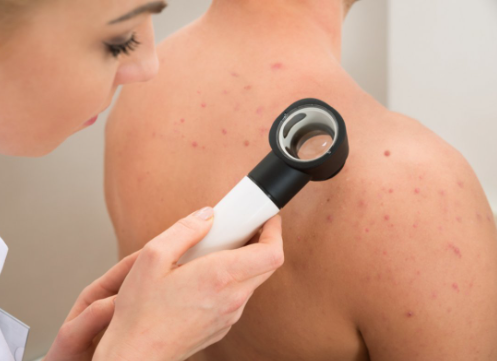 Foto - Fatih Sultan Mehmet'in tarihe geçen içeceği! Her tanesinde ayrı bir şifa var