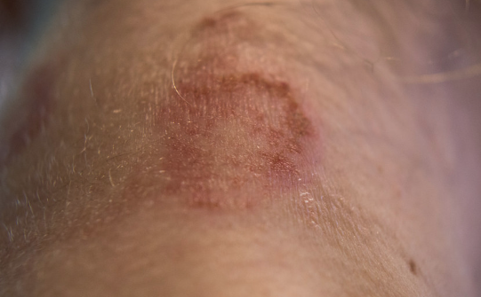 Foto - Fatih Sultan Mehmet'in tarihe geçen içeceği! Her tanesinde ayrı bir şifa var