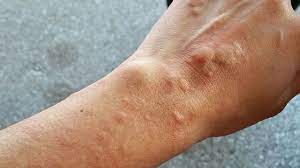 Foto - Faydaları saymakla bitmeyen bitki: Çam yağı! Meğer öyle bir faydası varmış ki, şu an duyan büyük şok geçirebilir