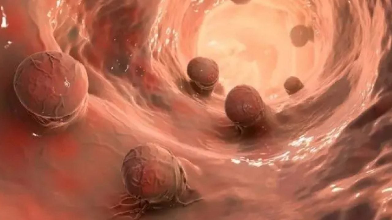 Foto - Fazla tüketenler dikkat: Meğer kansere davetiye çıkarıyormuş!