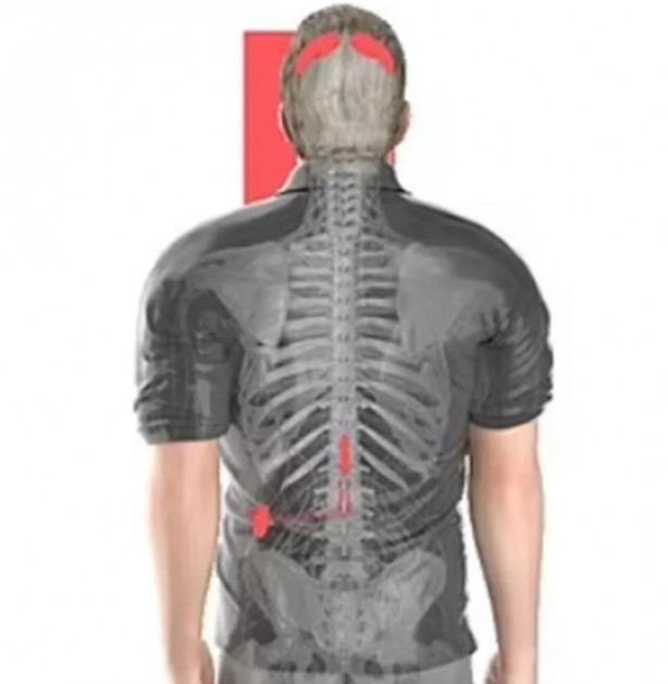 Foto - Felçlilere umut oldu! Beyne takılan cihazla yürümeye başladı