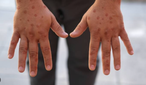 Foto - FETÖ durmuyor! Yalanlardan yalan beğen… İşte en son yalan