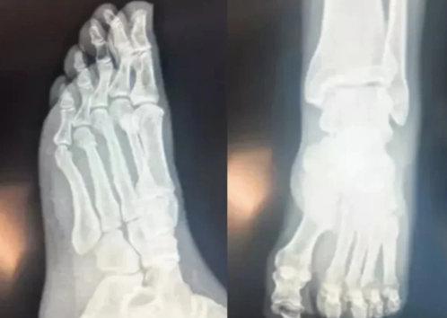 Foto - Fetö’nün parlatıp gündeme taşıdığı Özgür Özel’in Fetö ile tarihsel husumeti varmış! Acaba gerçekten de böyle mi? Açıklıyoruz…