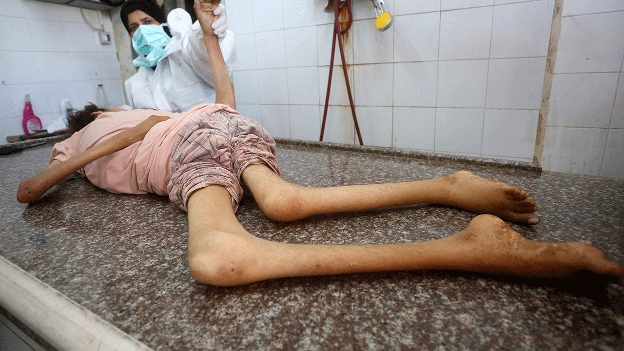 Foto - Filistin'de 127'si çocuk 348 kişi açlıktan şehit oldu