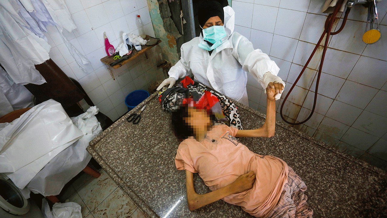 Foto - Filistin'de 127'si çocuk 348 kişi açlıktan şehit oldu