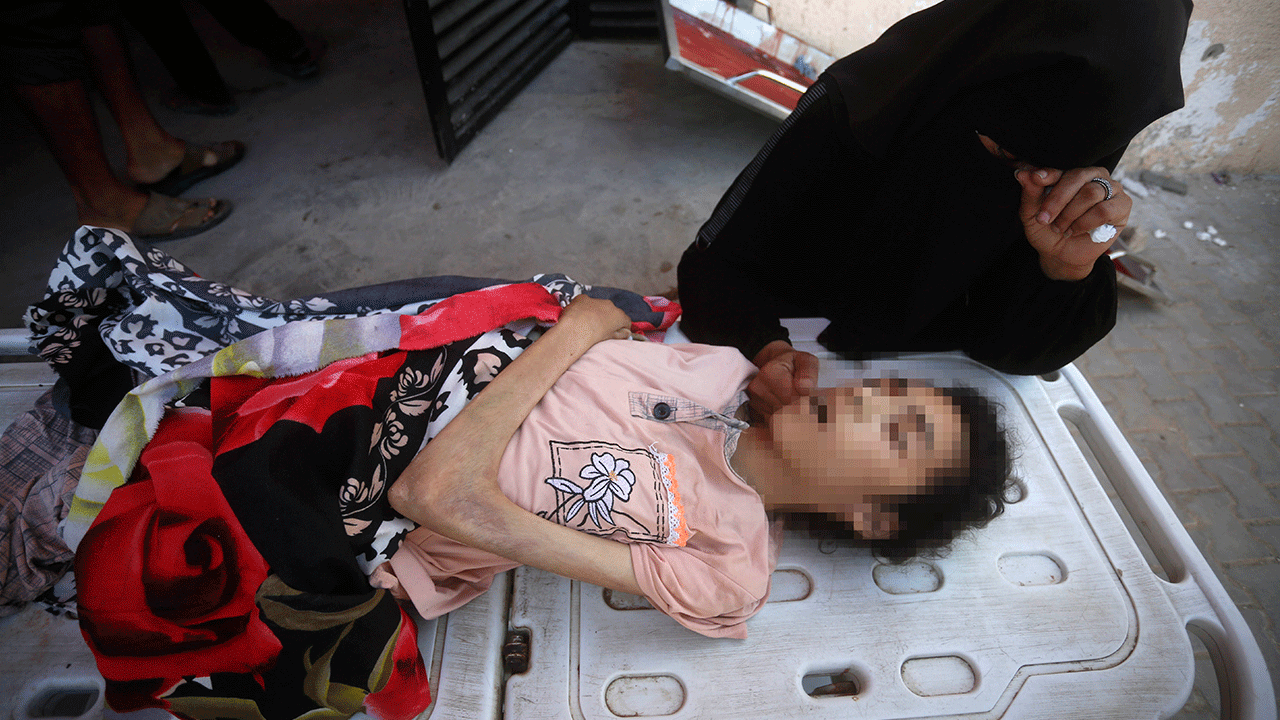 Foto - Filistin'de 127'si çocuk 348 kişi açlıktan şehit oldu