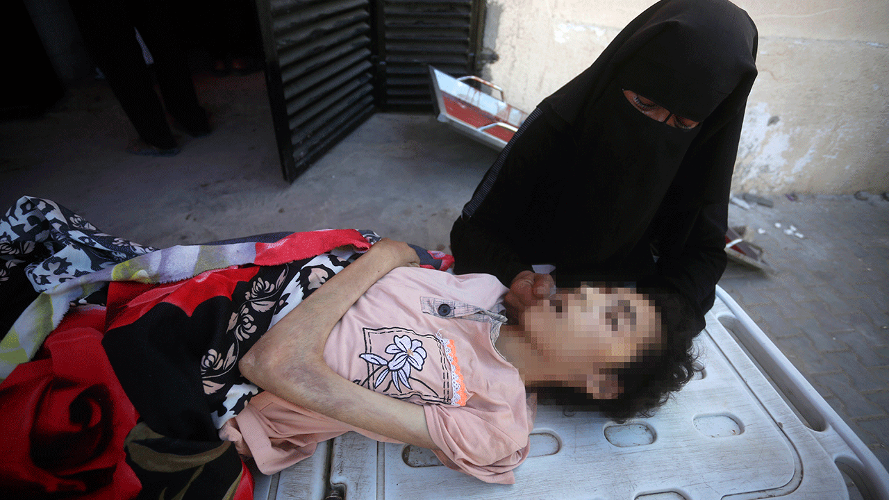 Foto - Filistin'de 127'si çocuk 348 kişi açlıktan şehit oldu