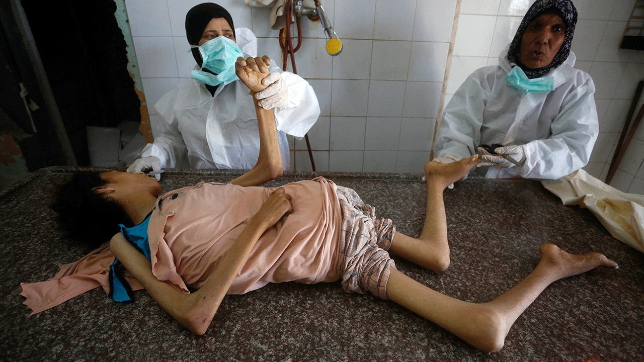 Foto - Filistin'de 127'si çocuk 348 kişi açlıktan şehit oldu