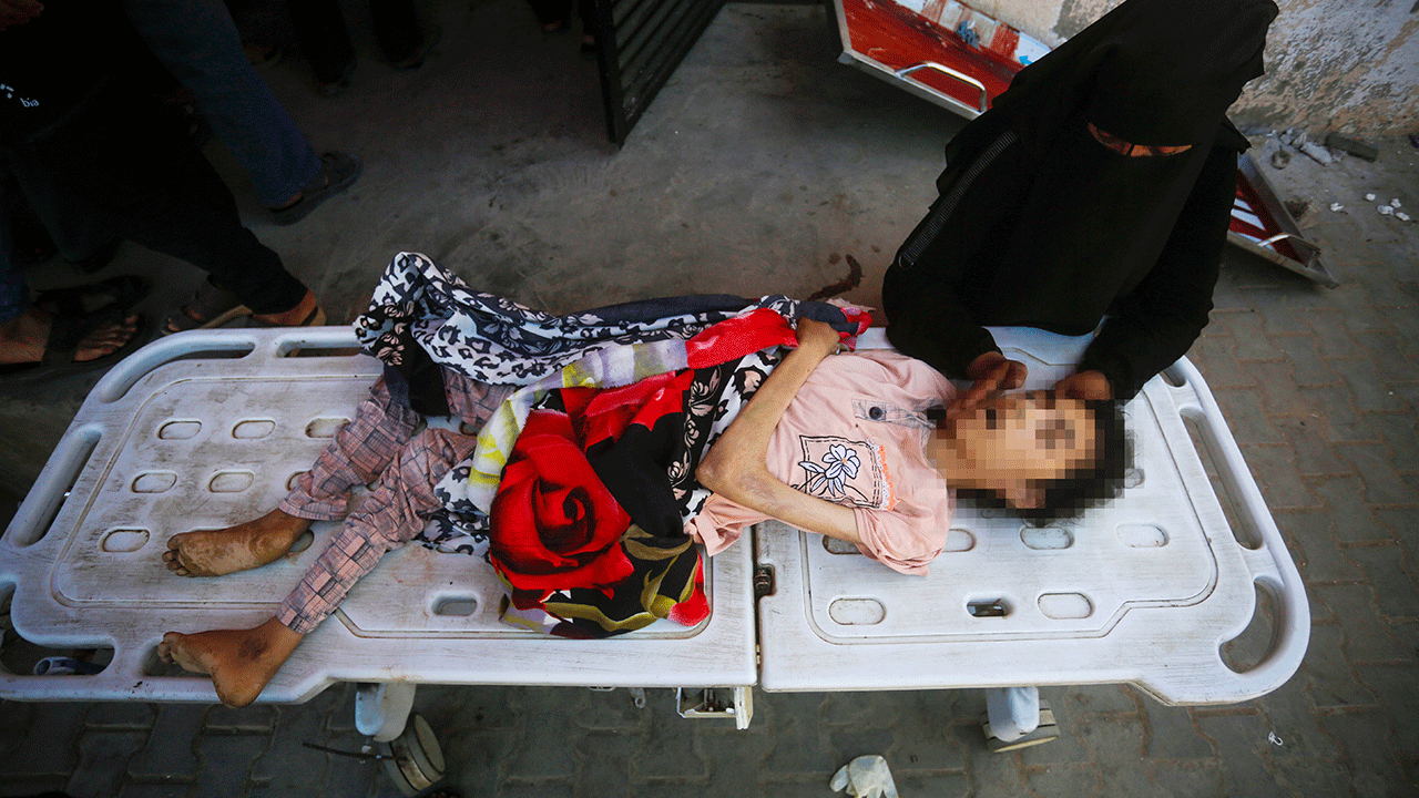 Foto - Filistin'de 127'si çocuk 348 kişi açlıktan şehit oldu