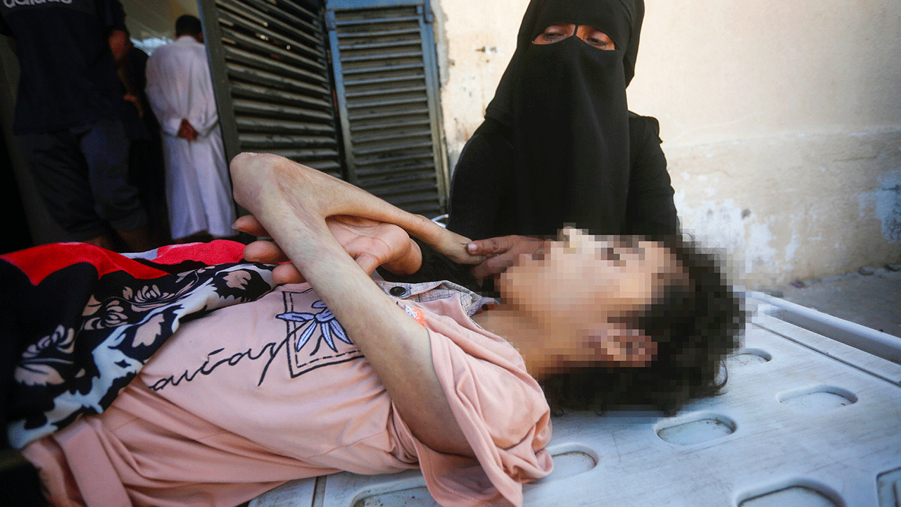 Foto - Filistin'de 127'si çocuk 348 kişi açlıktan şehit oldu