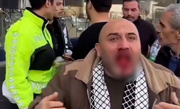 Foto - Filistin'e destek yürüyüşünden dönen adamın ağzını burnunu dağıtmıştı! O provokatörle ilgili Türkiye’yi ayağa kaldıran gelişme