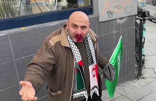 Foto - Filistin'e destek yürüyüşünden dönen adamın ağzını burnunu kırmıştı! O alçaklıkta flaş gelişme! Resmen şok olacaksınız